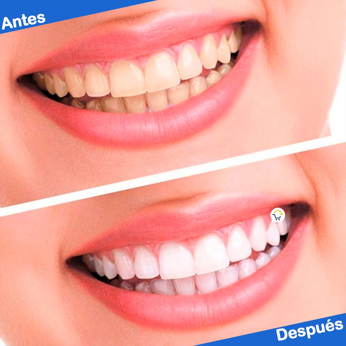 Tiras blanqueadoras de dientes 7 Piezas pegatina cuidado Dental 73D