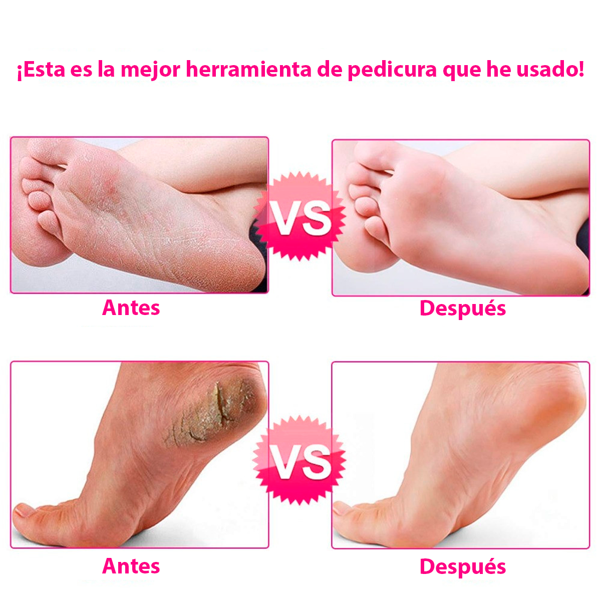 Quita Callos Eléctrico Removedor Recargable Para Pies XH-R01