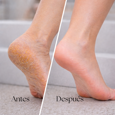 Quita Callos Eléctrico Profesional para Pies con 60 Lijas GH-99